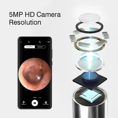 3.9mm HD Otoscope d'oreille numérique WiFi avec fonction directionnelle d'IA et connectivité WiFi