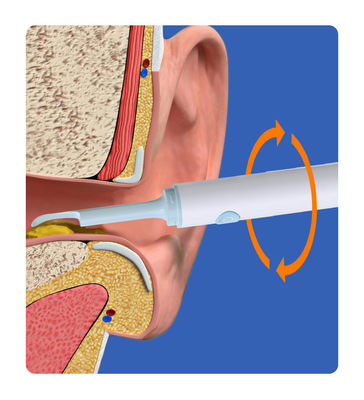 Rameau de nettoyage de l'oreille visuel intelligent Endoscope de caméra médicale pour autres produits chimiques ménagers
